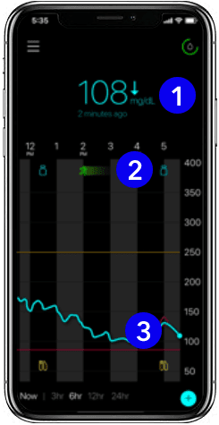 Continuous Glucose Monitor System