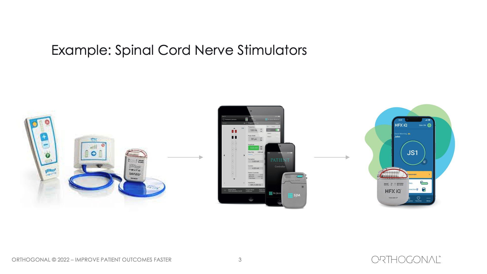 Example: Spinal Cord Nerve Stimulators